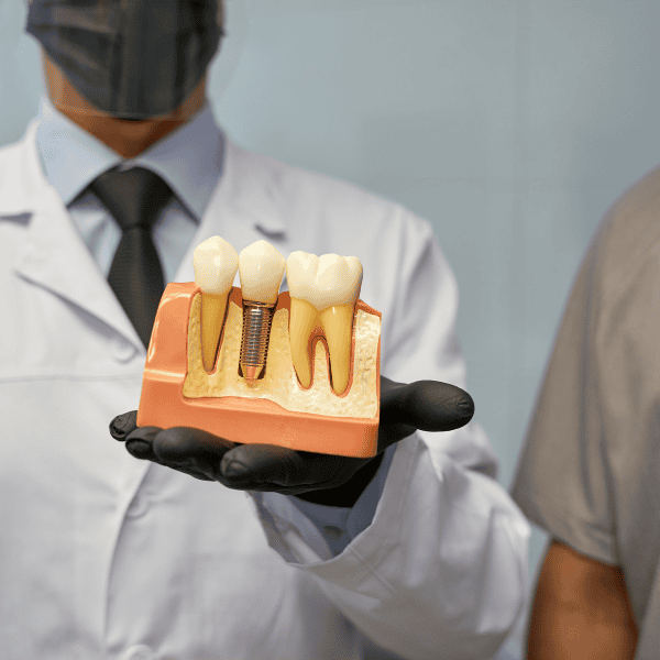 Teeth Replacement Image